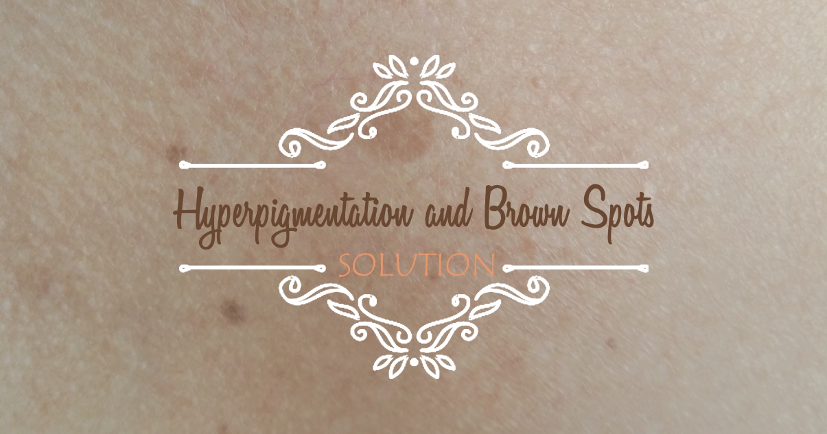 Solve the hyperpigmentation and brown spots problem